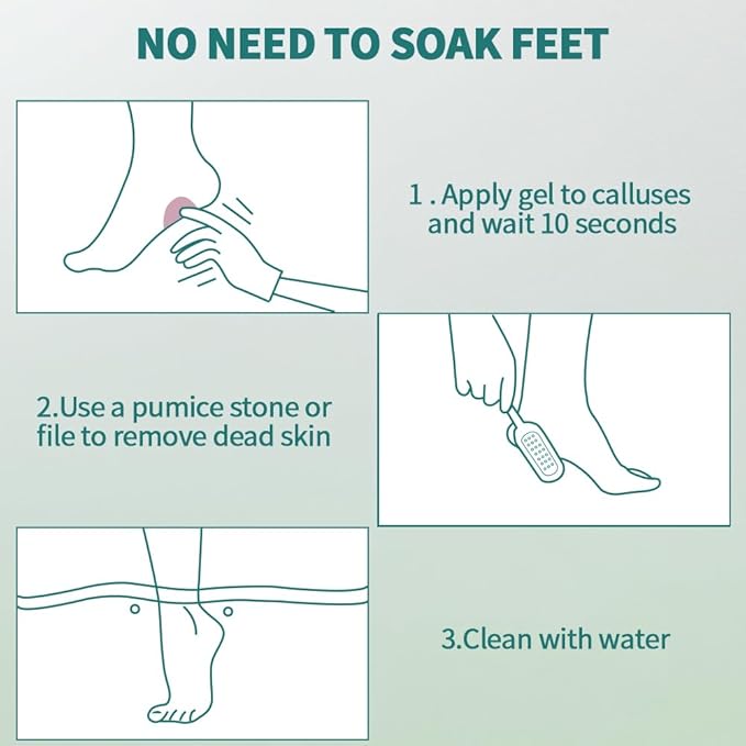 Gorgellux callus remover for feet,