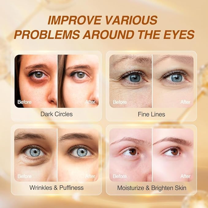 5% caffeine eye serum anti