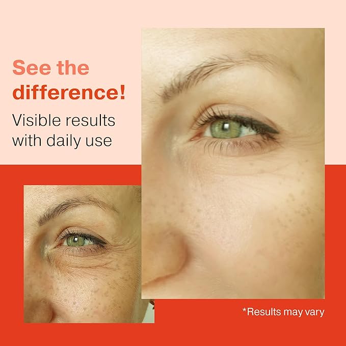 2X BIGGER 2OZ, Go Radiance 1% Retinol Serum for Face, Dark Spot Remover for Face, Anti Aging Serum, Pure Retinol for Face, Retinol Cream for face w/Aloe Vera, Rosemary, Calendula Extract, Made in USA