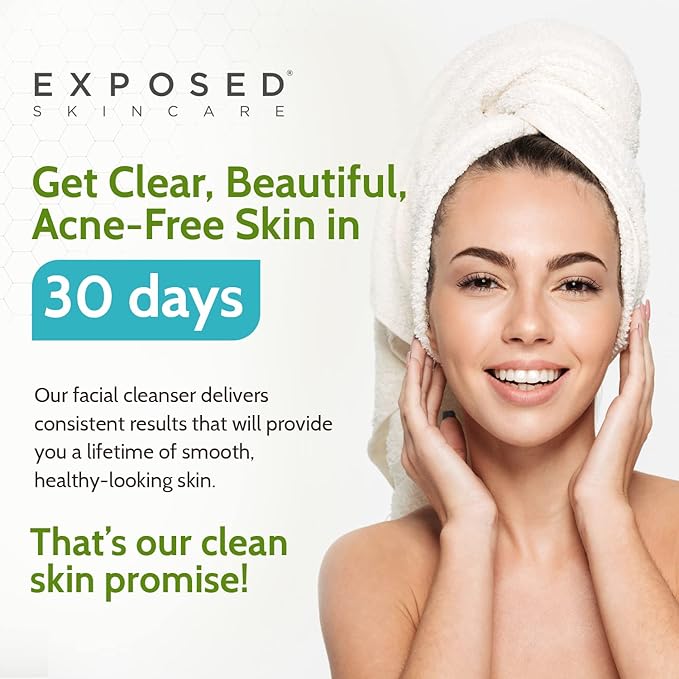 Exposed Skin Care Acne Facial Cleanser Clarifying