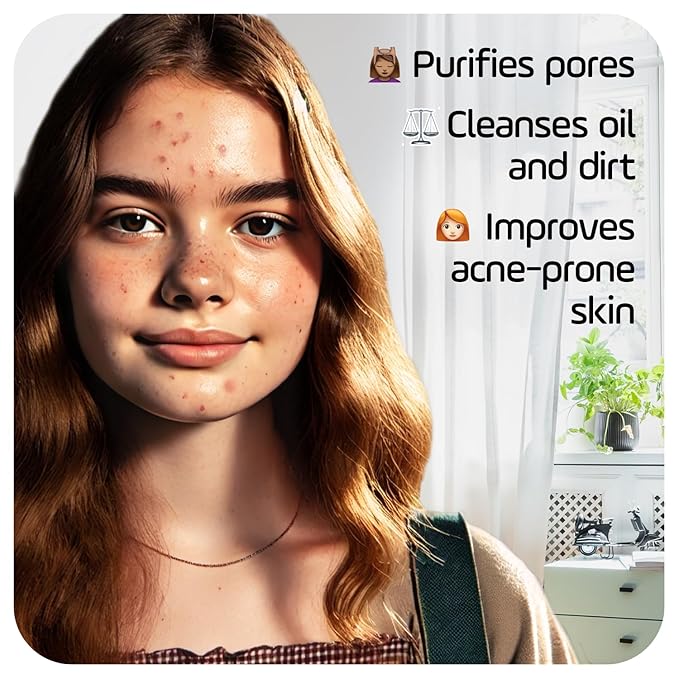 Asepxia Cleansing Bar Baking Soda, Multipack: Deep Skin Cleansing, Acne Fighting with 2% Salicylic Acid, Removes Oil and Dirt, Prevents Imperfections, Suitable for All Skin Types - 4 Oz, 5 Count