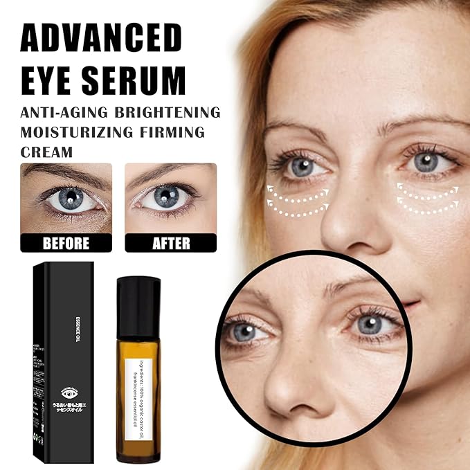 Time eraser roller ball castor