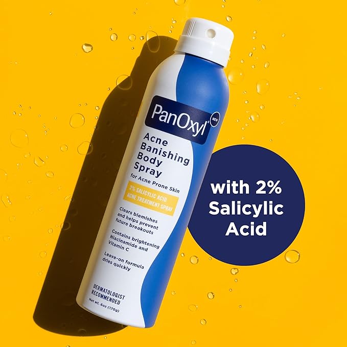 PanOxyl Acne Banishing Body Spray with 2% Salicylic Acid, Pimple Treatment to Clear Stubborn Breakouts, 360-Degree Spray Nozzle, Skin-Brightening Niacinamide, Vitamin C, Witch Hazel, Aloe, 6 Oz