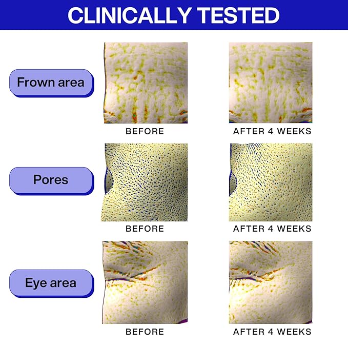 Iope retinol serum super bounce