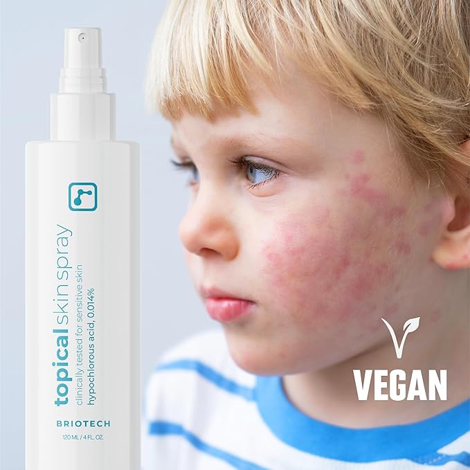 BRIOTECH Topical Skin Spray, Hypochlorous Acid Spray for Sensitive Skin, HOCl Facial Mist, Full Body Support Against Irritation, Calm Redness, Soothe Foot & Scalp, Travel Size 2 oz