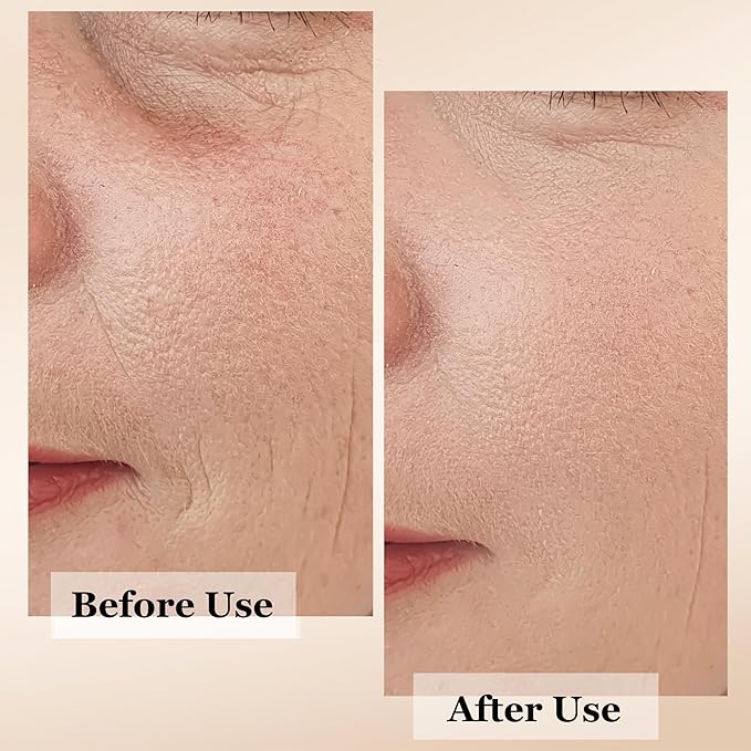 mivida Anti-Aging Super Serum with Retinol, Hyaluronic-Acid, Rosehip Oil, Vitamin C | All-In-One Face Serum For Wrinkles, Fine Lines, Dark Spot | 1oz