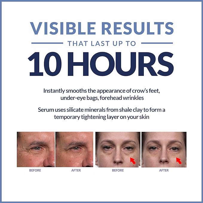 Plexaderm rapid reduction eye serum