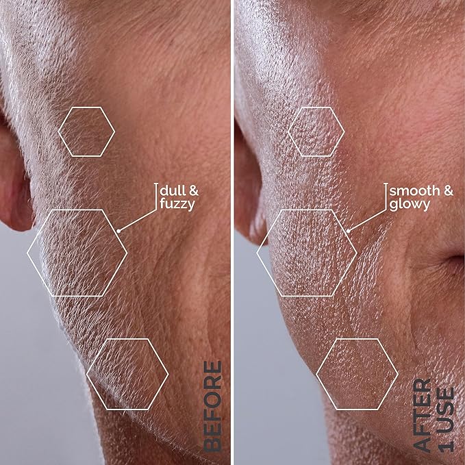 Michael Todd Beauty - Sonicsmooth – SONIC Technology Dermaplaning Tool - 2 in 1 Women’s Facial Exfoliation & Peach Fuzz Hair Removal System with 8 Weeks of Dermaplaning Blades