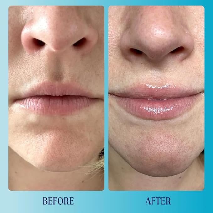 Kinship Supermelt Lip Plumping Jelly Mask - Moisturizing 3 oz