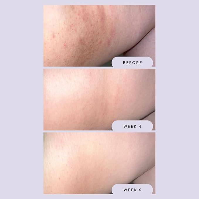 Megababe Night Rescue | Brightening &