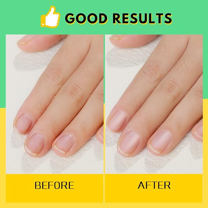 FANDAMEI Nail Buffer and File,