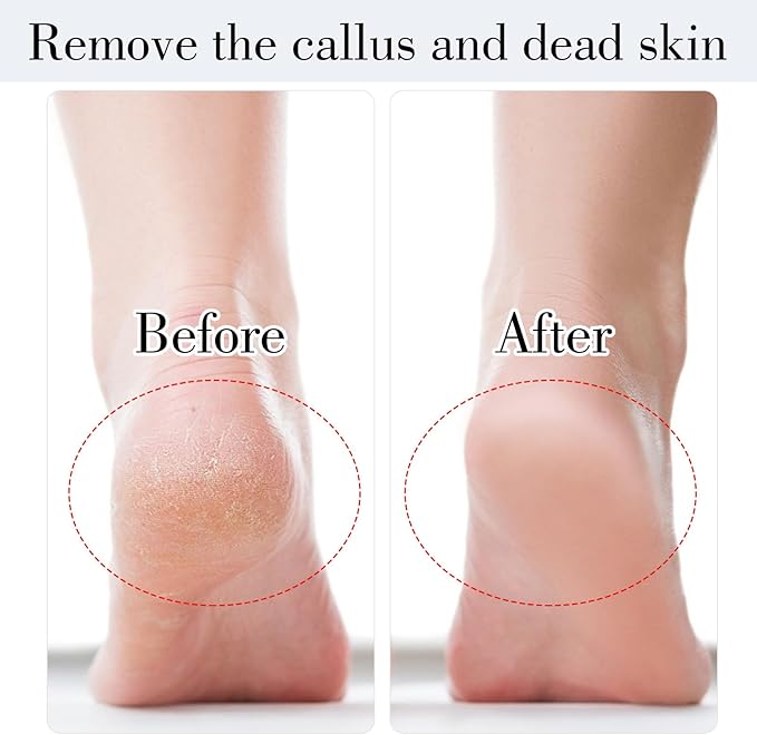 Stainless Steel Foot File, Metal