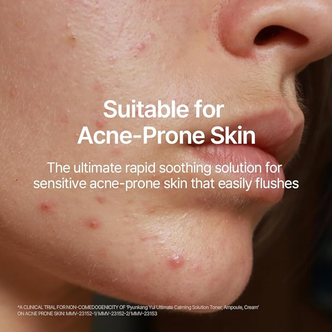 Pyunkang Yul Ultimate Line Skincare Set, Mother's day gift for mom, Calming Solution Toner, Ampoule & Cream, Traditional Korean-Style Packaging, Zero-Irritation (3-item set)