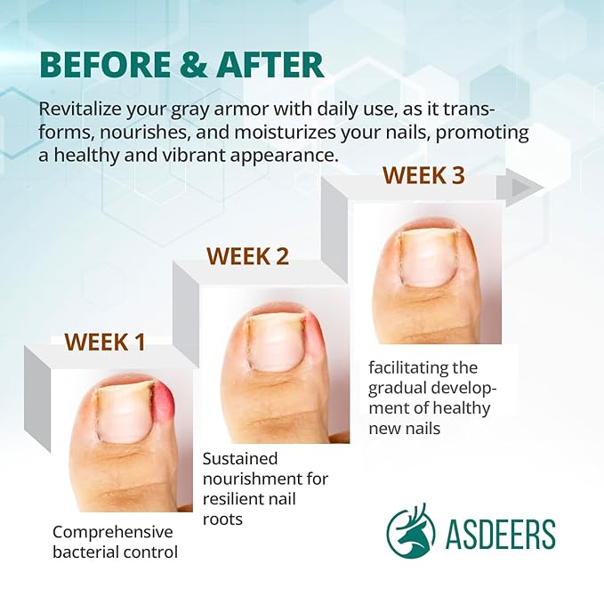 Ingrown toenail treatment: ingrown toenail