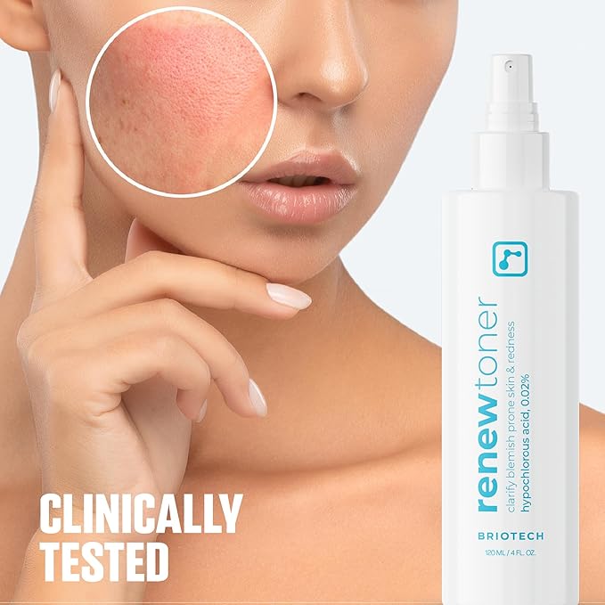 BRIOTECH Skin Renew Toner, Hypochlorous Acid Spray Topical Skin Spray for Face and Skin, Minimize Appearance of Blemishes, Soothing Mist for Redness & Bumps, 4 fl oz ea, 4 ct