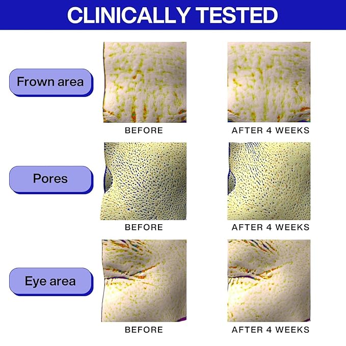 IOPE Retinol Super Bounce Serum | Korean Retinoid Eye Treatment for Anti-Aging, Beginner Friendly, Reduction in Fine Lines & Wrinkles, Firming and Rejuvenating, Daily Glow Routine, 1.69 Fl Oz. (50ml)