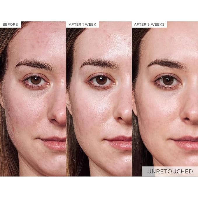 Glow Recipe Avocado Ceramide Serum, Travel Size - Soothing, Hydrating Face Serum for Women & Men, Redness Relief & Skin Barrier Repair - Lightweight Korean Skincare for Dry, Sensitive Skin (15 ml)