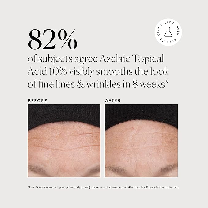 Naturium Azelaic Topical Acid 10%, Face & Skin Care Beauty Treatment with Niacinamide & Vitamin C, 1 oz