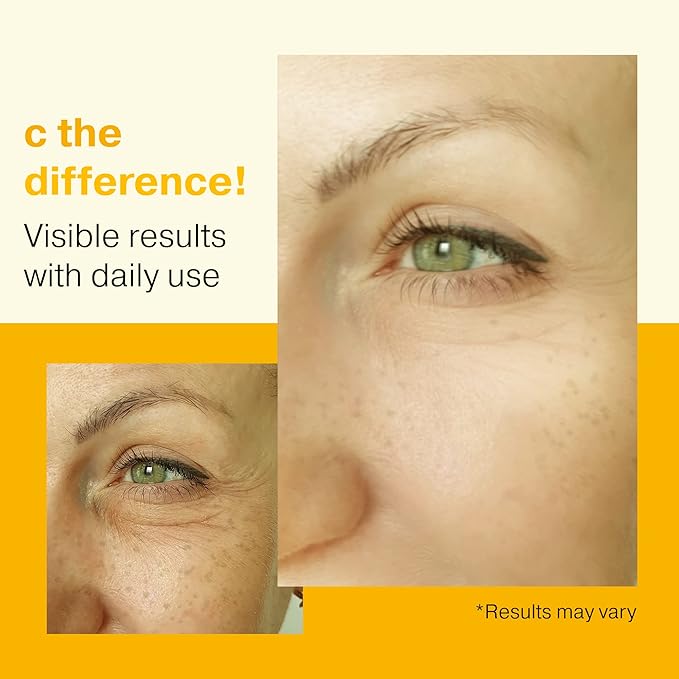 Double Size (2OZ), 20% Vitamin C Serum for Face with Hyaluronic Acid, Face Serum Vitamin C, Vitamin C for Face Serum for Women, Vitamin C Oil for Face, Vit C Serum for Face, Vitamin C Face Serum