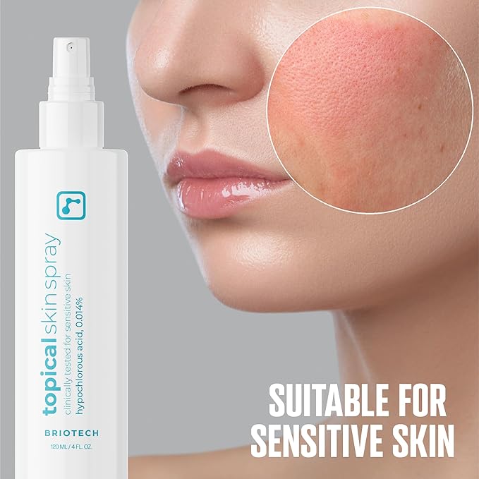 BRIOTECH Topical Skin Spray, Hypochlorous Acid Spray for Body & Face, Eyelid Cleanser, HOCl Facial Mist, Support Against Irritation, Calm Redness, Soothe Foot & Scalp, 128 fl oz (4 Pack)