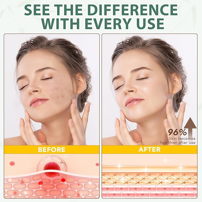 Beef Tallow for Skin, Beef Tallow Moisturizer, 4.2 oz Organic Whipped Grass Fed Beef Tallow with Honey Cream for Face & Body, Unscented