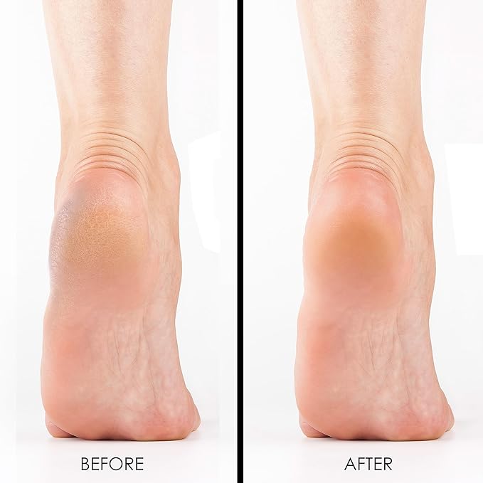 DeEnti Double Pumice Pack, Bundle