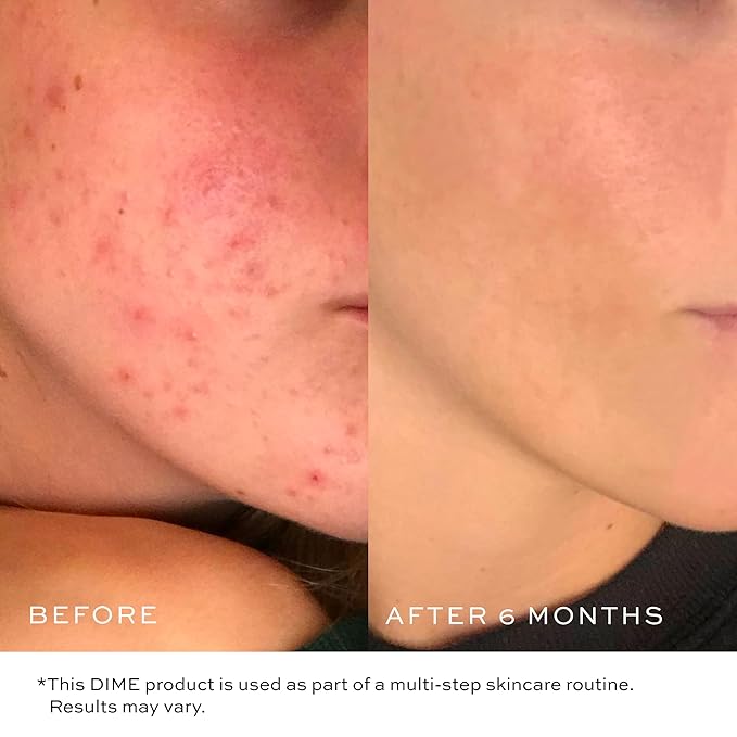 DIME Beauty Gentle Jelly Cleanser, Hydrating Facial Cleanser and Makeup Remover with Vitamin E, Sensitive Skin Face Wash, 4 oz / 120 ml