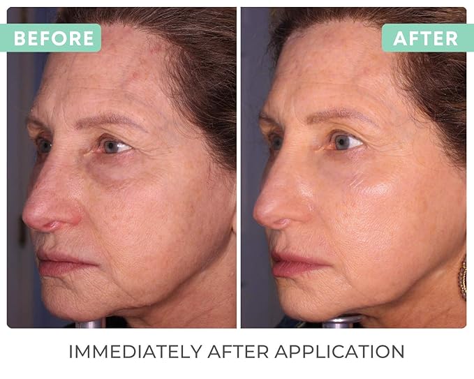 Reflect SPF 42 Tinted Mineral Sunscreen Lotion, Zinc Oxide & Titanium Dioxide, Hyaluronic Acid & Vitamin E, Acne Sunblock, Medical Grade Anti-Aging Face Moisturizer with SPF 2.1 OZ