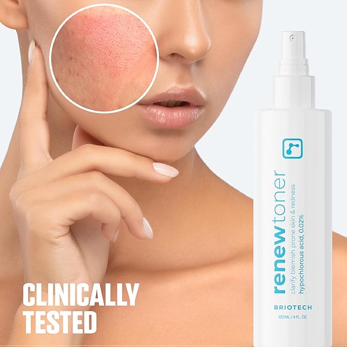 BRIOTECH Renew Toner, Hypochlorous Acid Spray, Minimize Appearance of Blemishes, Soothing Facial Mist for Sensitive Skin, Calm Redness & Bumps, Hypoallergenic & Vegan, 2 fl oz Travel Size (2)