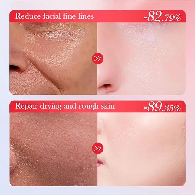 Goji Berry Skincare Sets, 6 In Aging