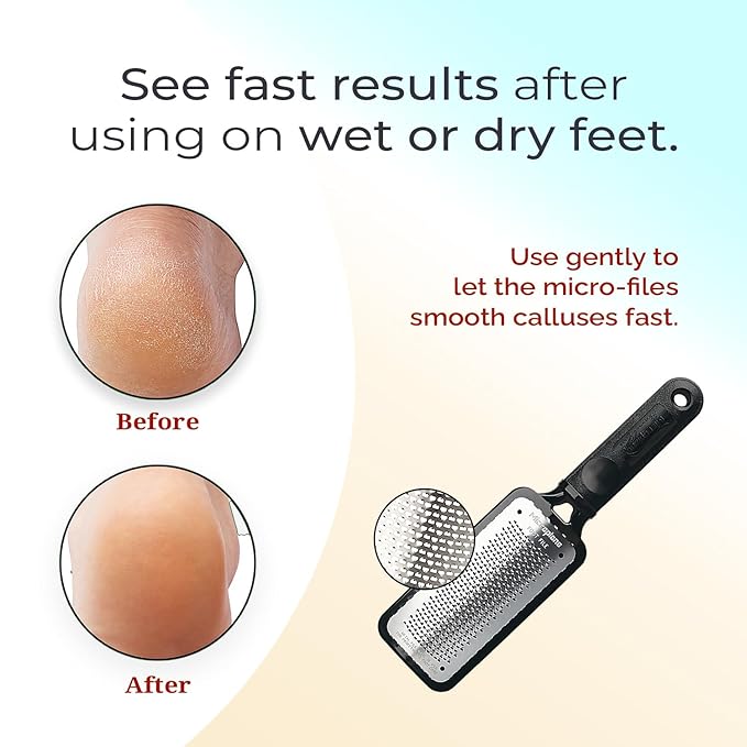 Microplane Colossal Foot File, Red and Black - The Original Stainless-Steel Foot Scraper, Dead Skin/Callus Remover for Feet, Foot Scrubber, Pedicure Tools for Salon-Quality Foot Care (2 Piece Set)