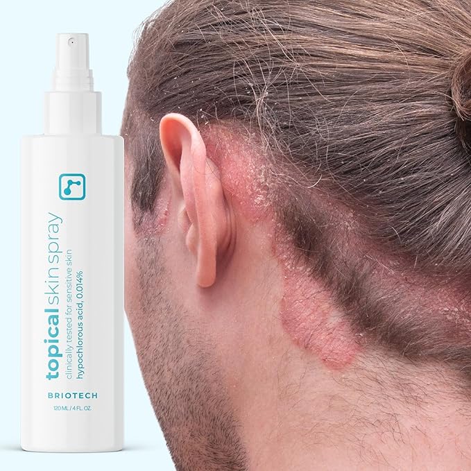 BRIOTECH Topical Skin Spray, Hypochlorous Acid Spray for Body & Face, HOCl Facial Mist, Support Against Irritation, Redness, Packaging May Vary, 4oz (2 Pack)