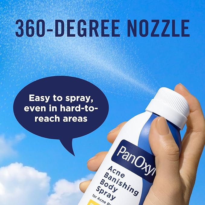 PanOxyl Acne Banishing Body Spray with 2% Salicylic Acid, Pimple Treatment to Clear Stubborn Breakouts, 360-Degree Spray Nozzle, Skin-Brightening Niacinamide, Vitamin C, Witch Hazel, Aloe, 6 Oz