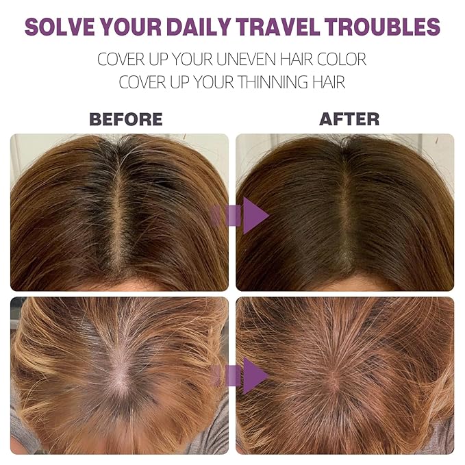 Hairline Powder Instantly Conceals Hair