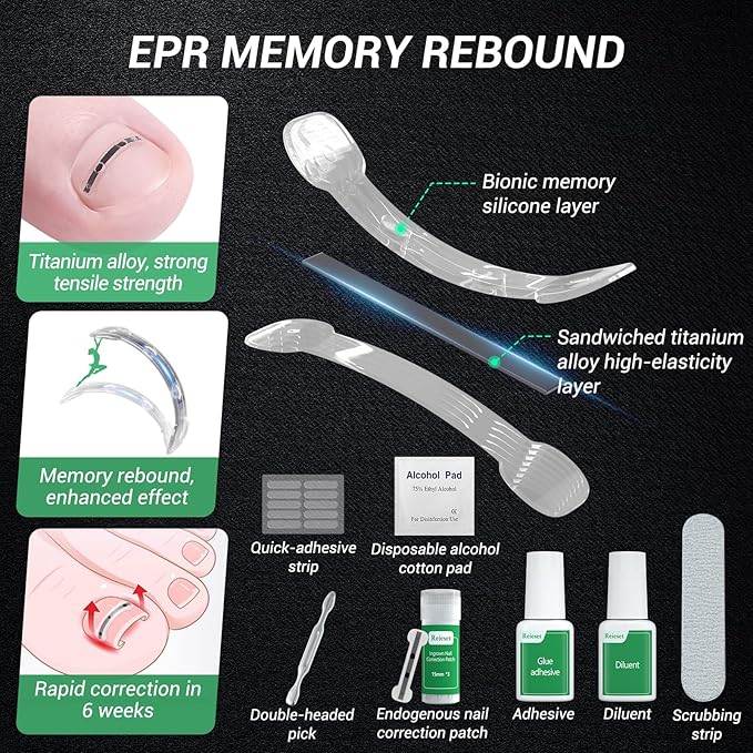 Titanium alloy ingrown toenail treatment-