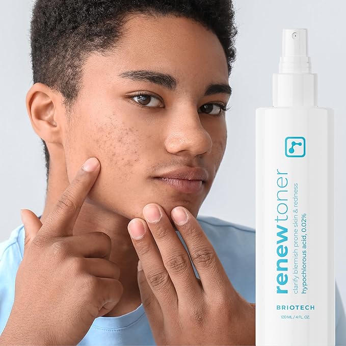 BRIOTECH Skin Renew Toner, Hypochlorous Acid Spray Topical Skin Spray for Face and Skin, Minimize Appearance of Blemishes, Soothing Mist for Redness & Bumps, 4 fl oz