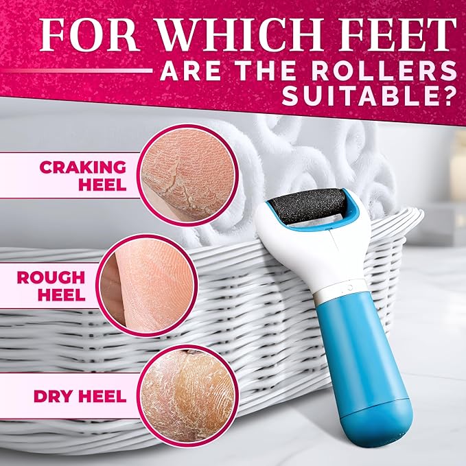 Electric callus remover for feet