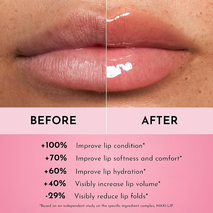 Forget the Filler Lip Plumping Line Smoothing Gloss - Cherry Vanilla - Premium Volumizing Lip Gloss with Natural Ingredients Designed to Plump, Firm, and Hydrate Lips 0.11 oz