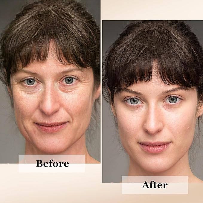 Ultimate Hydration & Anti-Aging Hyaluronic-Acid Facial Serum | with CoQ10, Vitamin B, Vitamin C & Chamomile Extract | Soothing, Plumping & Renewing | For Sensitive Skin | Non greasy 1 fl oz