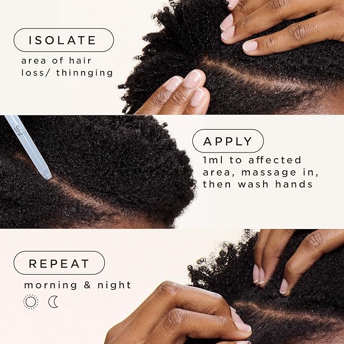 Carol's Daughter Goddess Strength Hair Regrowth Treatment for Women, 2% Minoxidil Solution for Hair Loss and Thinning, One Month Supply, 2 Fl Oz