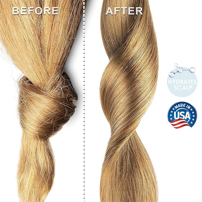 Soapeauty MEADOWFOAM SEED OIL Cold Pressed Unrefined | 100% Pure Natural Meadowfoam Seed Oil for Face & Hair | Moisturizer for Skin, Promotes Hair Growth, Balms | 8 fl oz